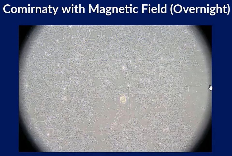 Comirnaty oltás mikroszkóp alatt miután mágneses térben volt néhány óráig