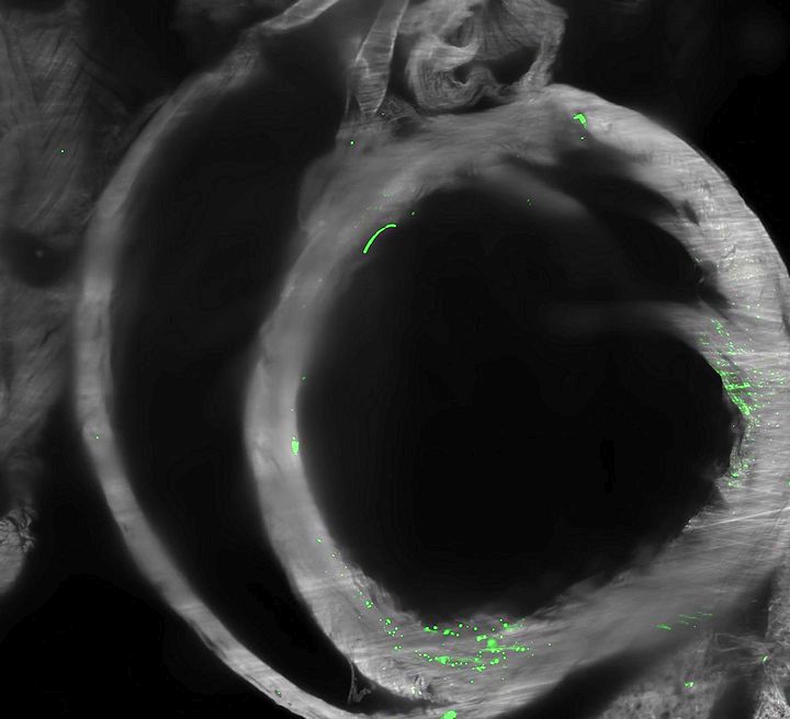 Az S1 fehérje eloszlása egy egér testében ​S1 fehérje intravénás beadása után
