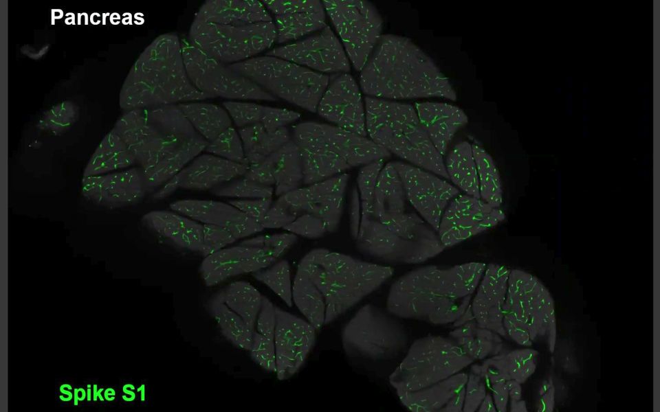 S1 fehérjék egy egér agyának prefrontális kérgében S1 fehérje intravénás beadása után